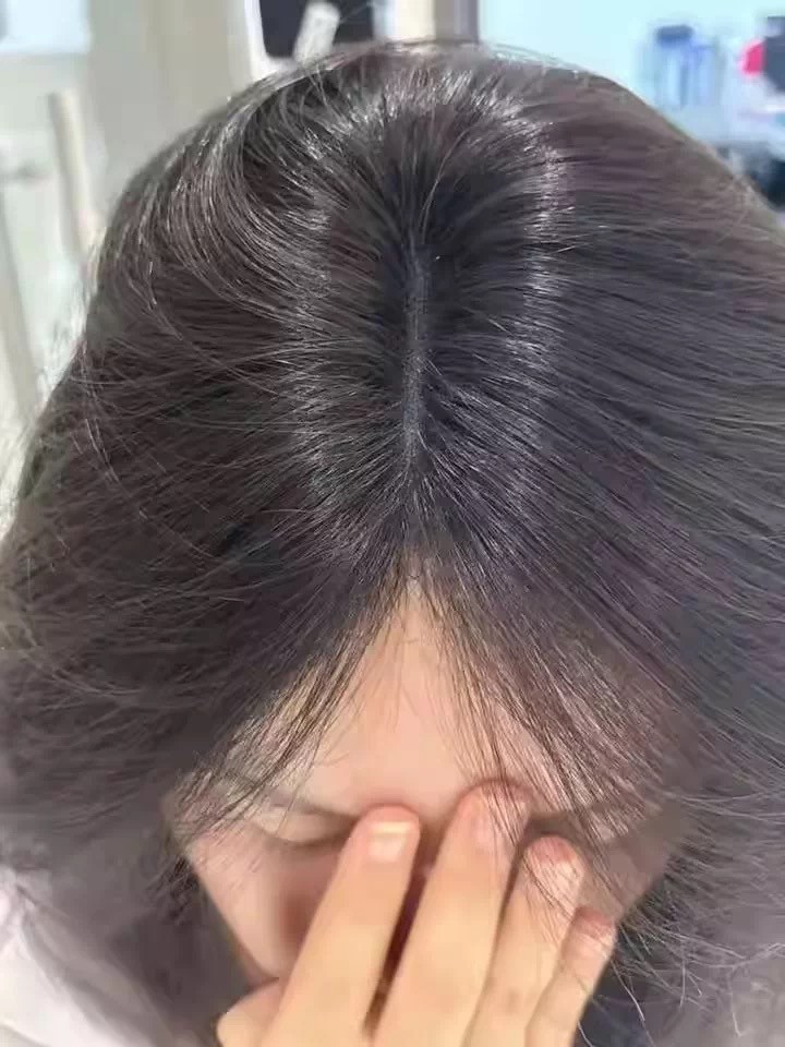 2026 综合测评|帕思玛敏感头皮专用洗发皂总结