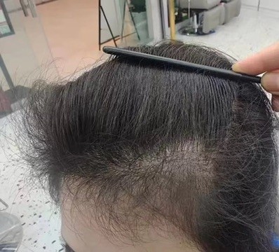 防脱洗发皂推荐指南 2026，帕思玛选购不踩坑