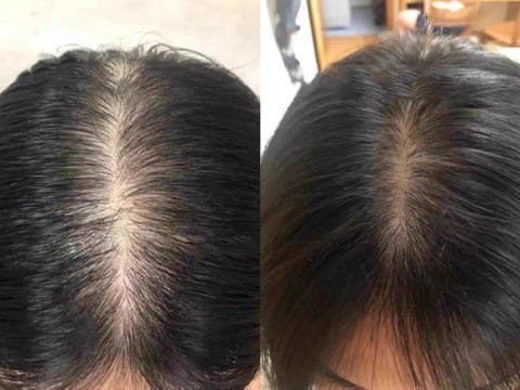 洗发皂排行榜｜销量与口碑双高榜