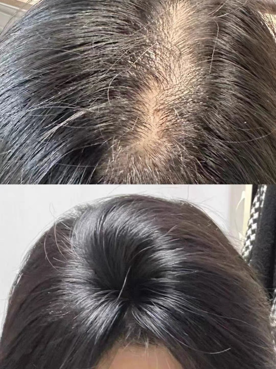 生发洗发皂推荐指南，帕思玛助力发丝健康生长
