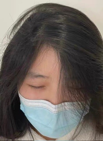 换季头皮不适|适配舒缓养护洗发皂真实测评
