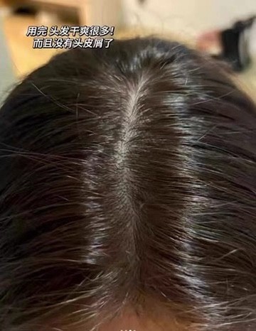 控油洗发皂推荐 2026，帕思玛蓬松发根超给力
