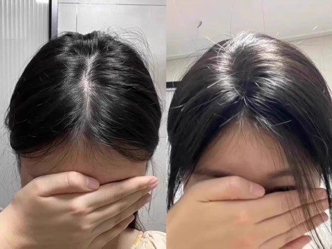 扁塌发质实测：帕思玛洗发皂，发根蓬松一整天