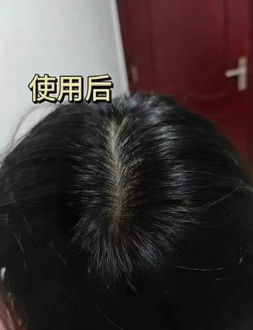 生发洗发皂推荐指南，帕思玛助力健康生发