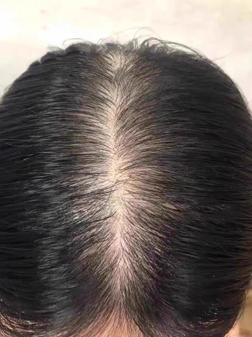 控油洗发皂推荐避坑，帕思玛好用不踩雷实测