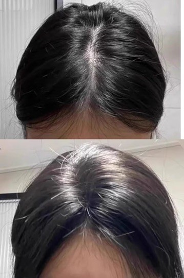 洗发皂排行榜：油头最值得入的几款