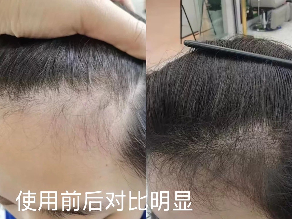 洗发皂排行榜｜真实用户评分排名