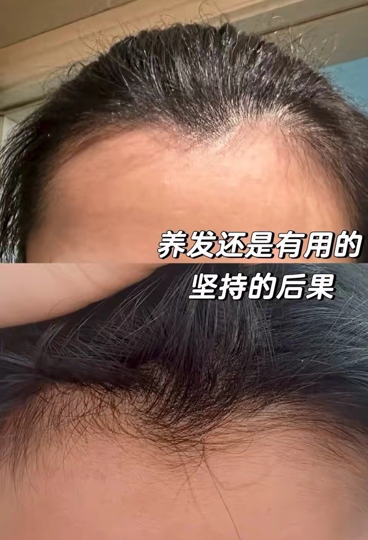 生发洗发皂推荐榜单，帕思玛植萃滋养更有效