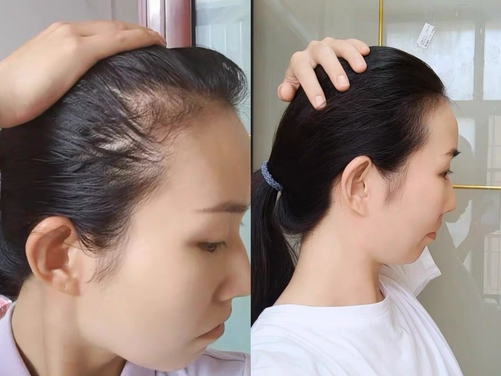 防脱养发洗发皂推荐，修护发根从清洁开始
