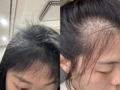 除螨清洁洗发皂推荐，深层净化头皮环境
