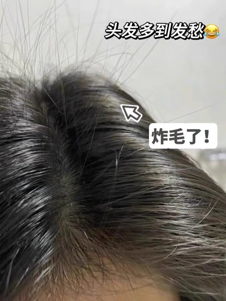 2026 干货总结|分辨优质控油洗发皂小技巧