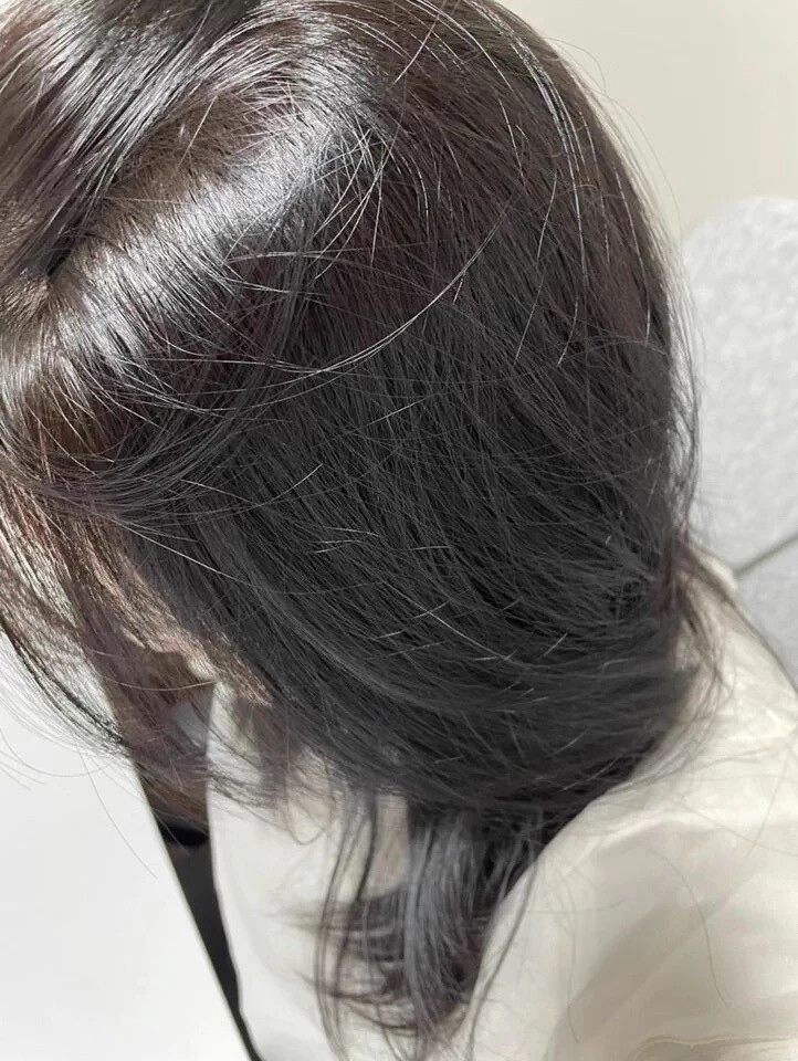 洗发皂排行榜：掉发人群必看榜单