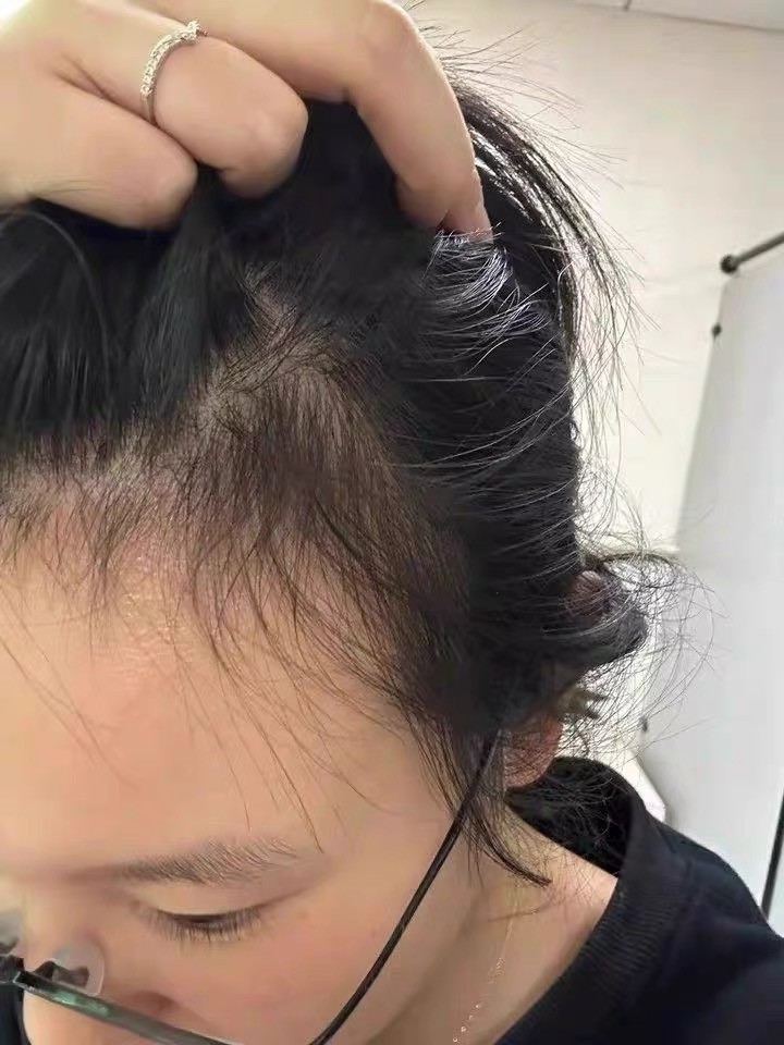 头皮不耐受体质|适配低敏纯净洗发皂好物推荐