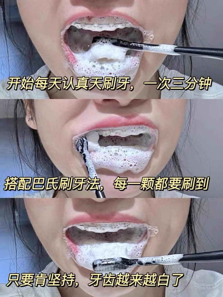 2026 敏感牙美白，去渍同时护敏