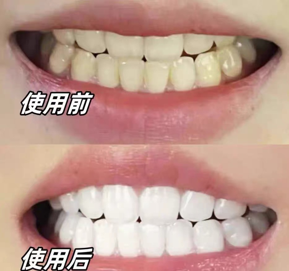 帕思玛牙膏测评：便携好用，出差旅行适配