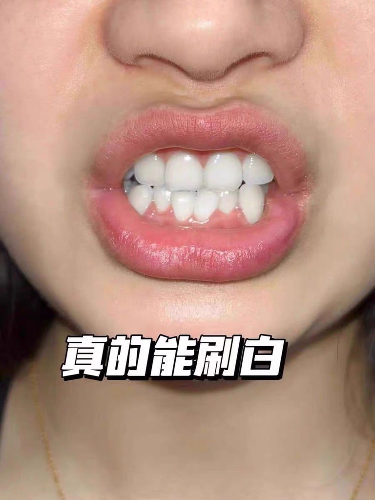 速效美白牙膏靠谱吗？2026实测帕思玛循序渐进更安全
