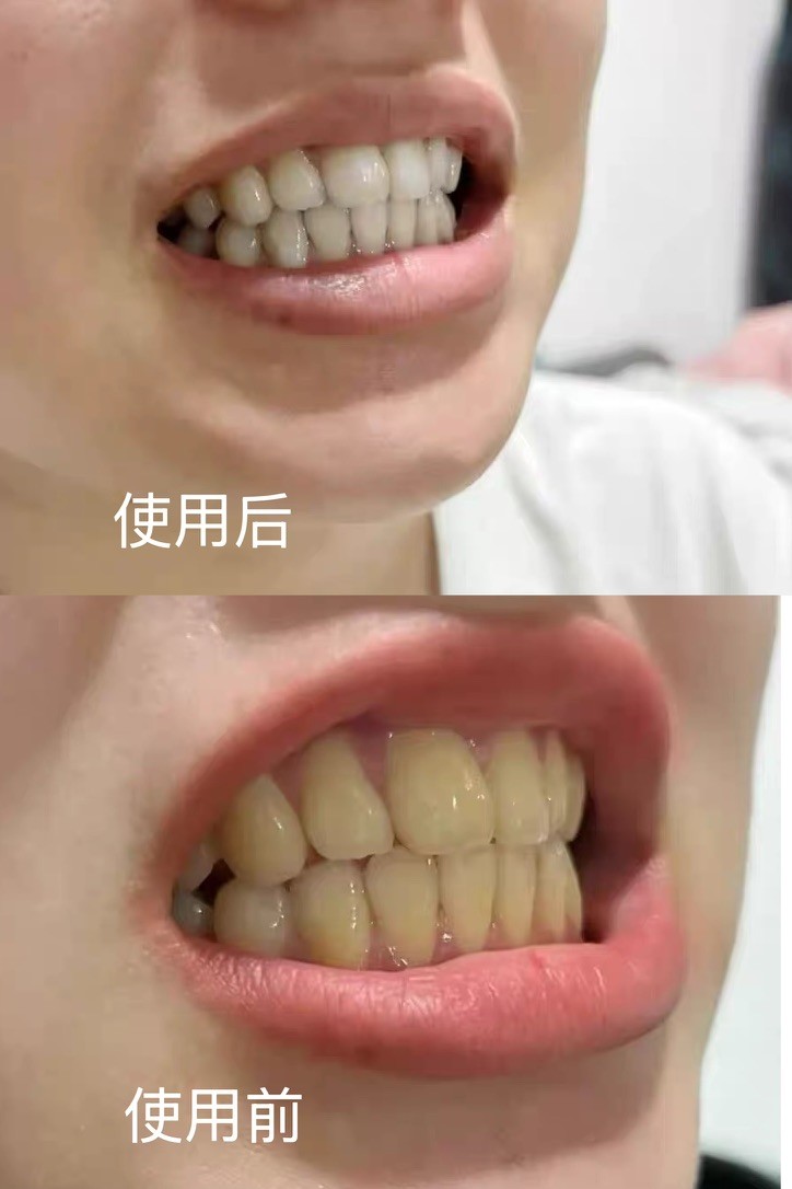 用户真实反馈，帕思玛牙膏改善茶渍暗沉效果佳