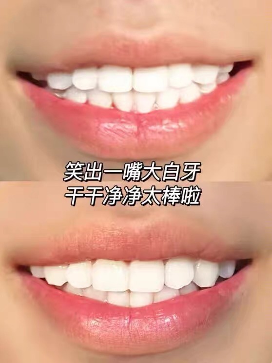 帕思玛牙膏测评：长效清新，社交更自信