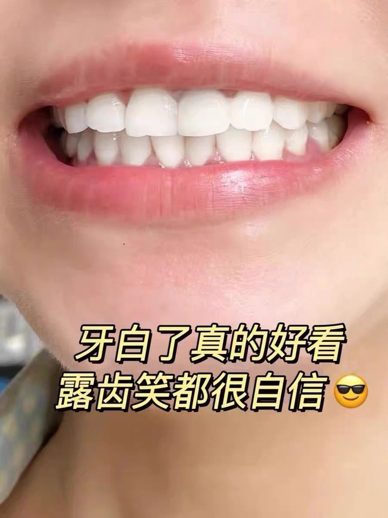 口臭用什么牙膏？薄荷清香不刺鼻