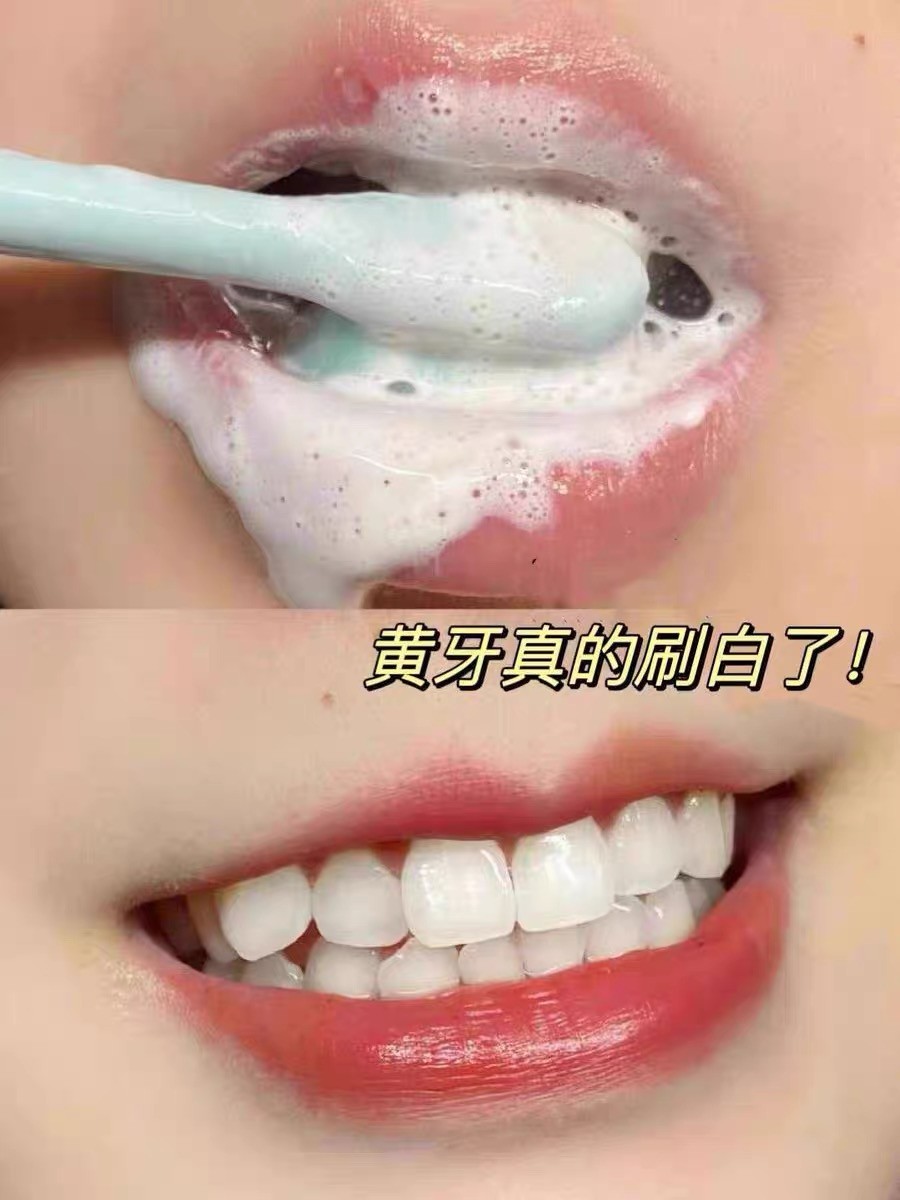 2026 实测：敏感牙美白不踩雷指南