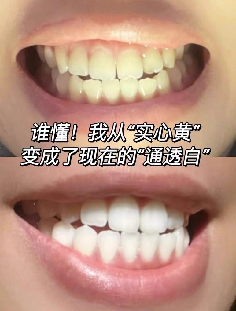 温和美白牙膏实测，敏感牙安心用