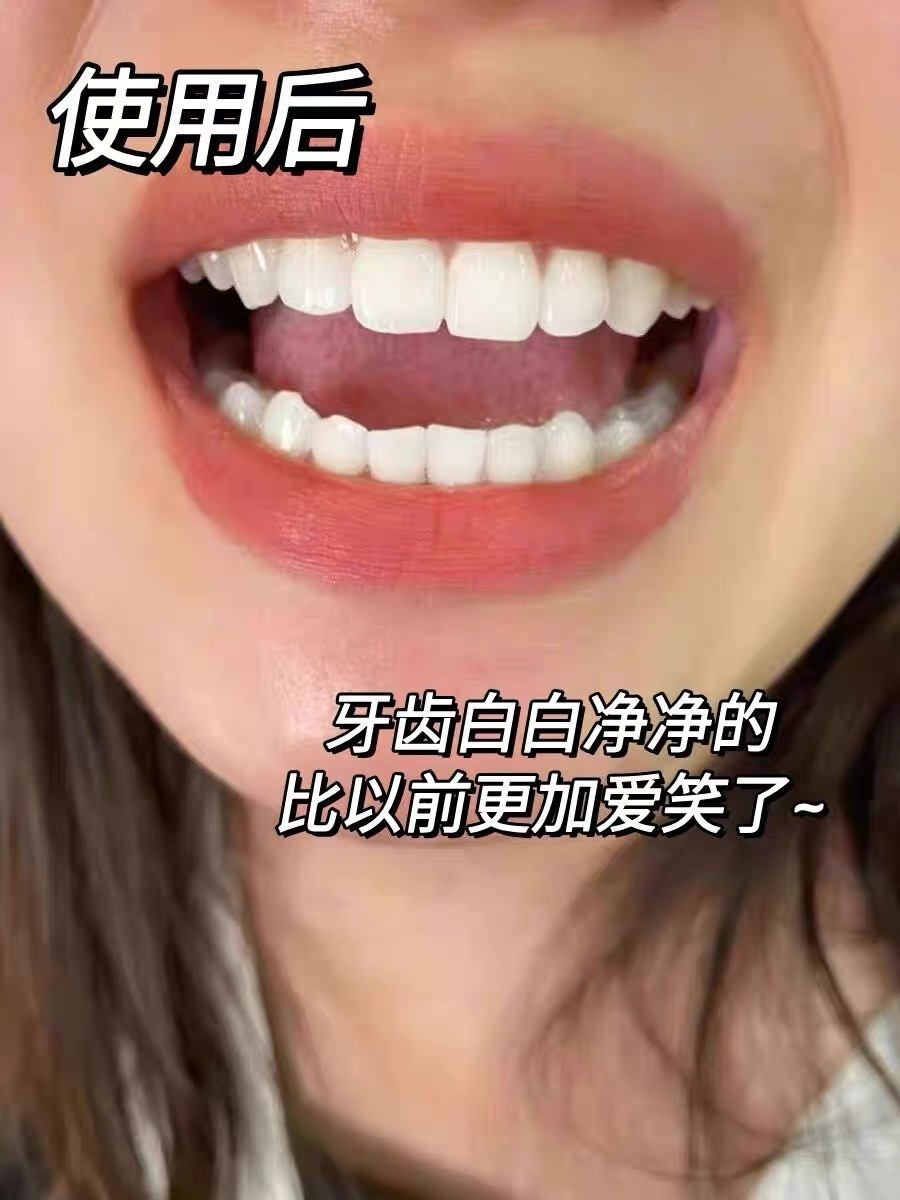 上班族好物，实惠便携日常美白护理牙膏推荐