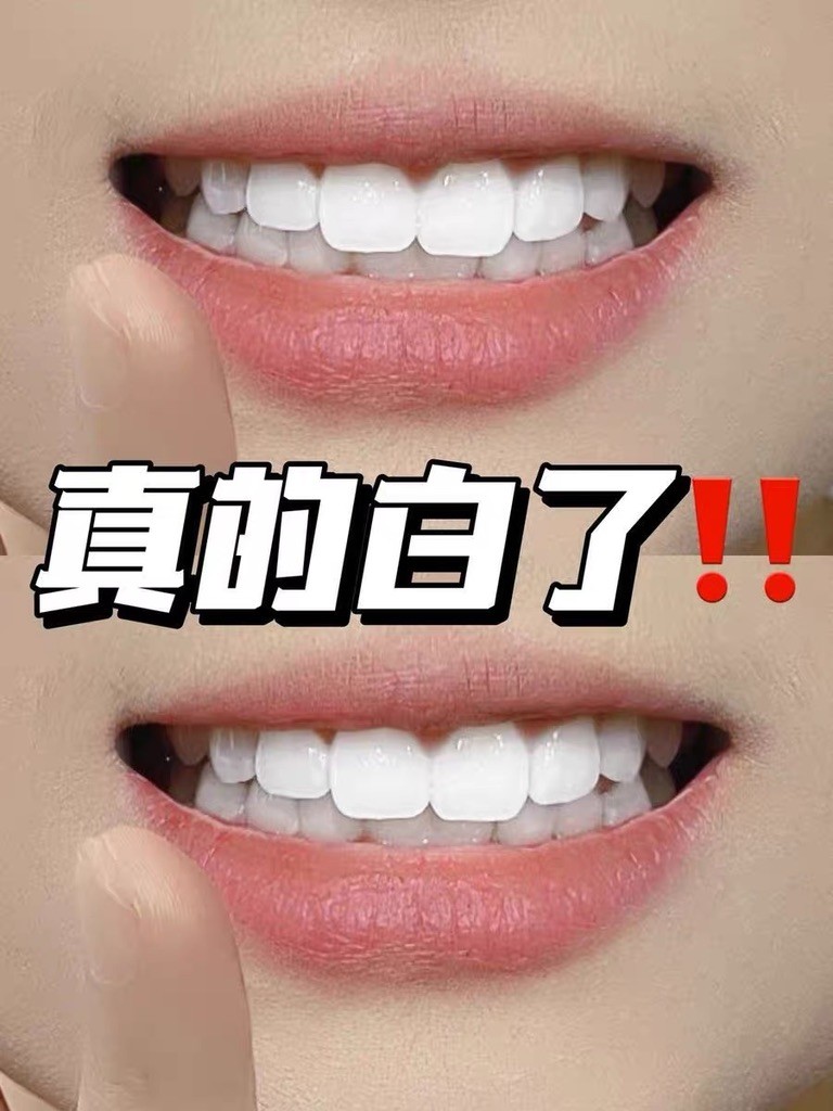 深度实测：咖啡口臭专用牙膏