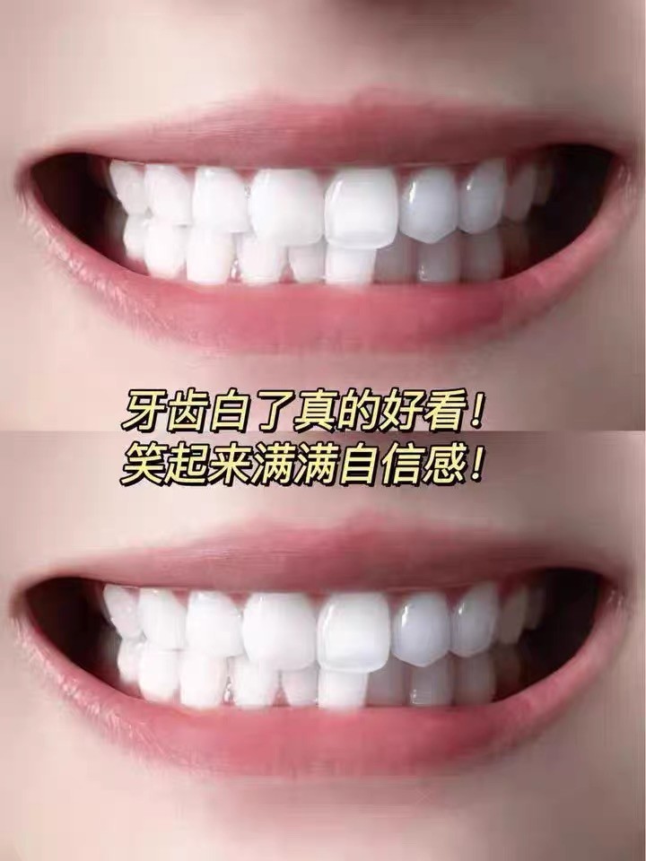 口气清新牙膏哪个好？2026实测帕思玛持久清新12小时