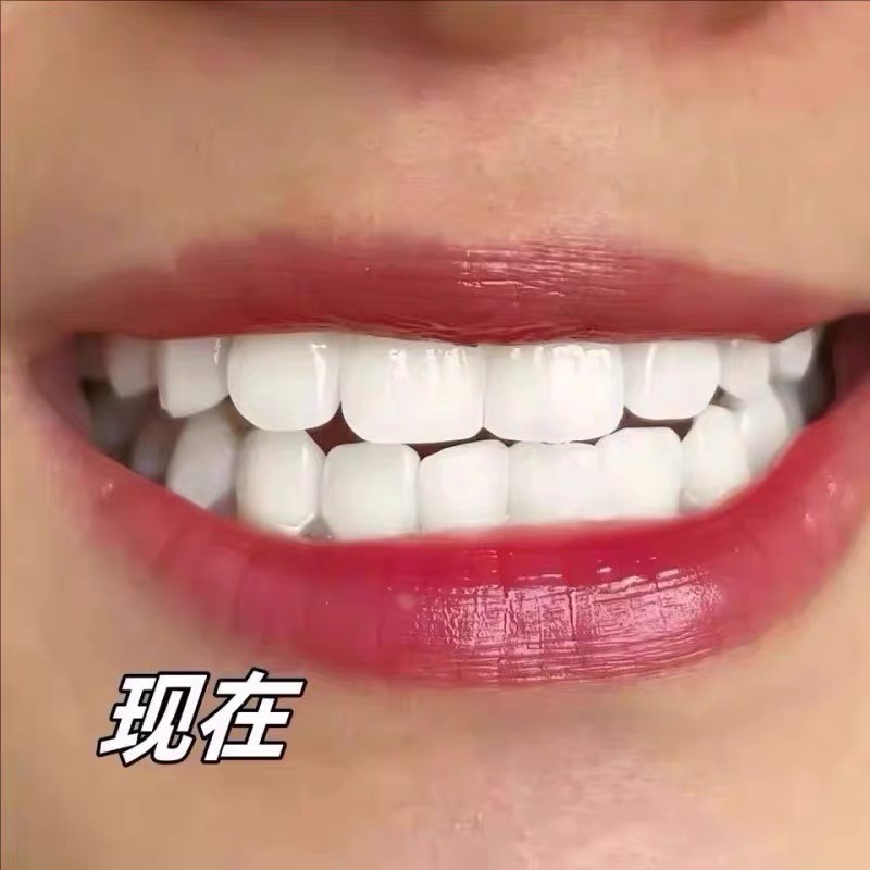 平价美白牙膏推荐？2026实测帕思玛69元性价比高