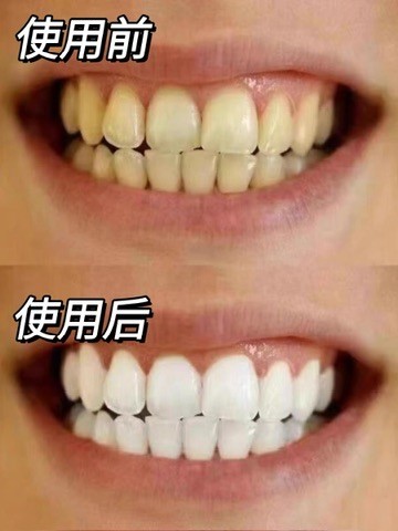 美白牙膏真的有效吗？2026实测帕思玛提亮1-2度有改善趋势