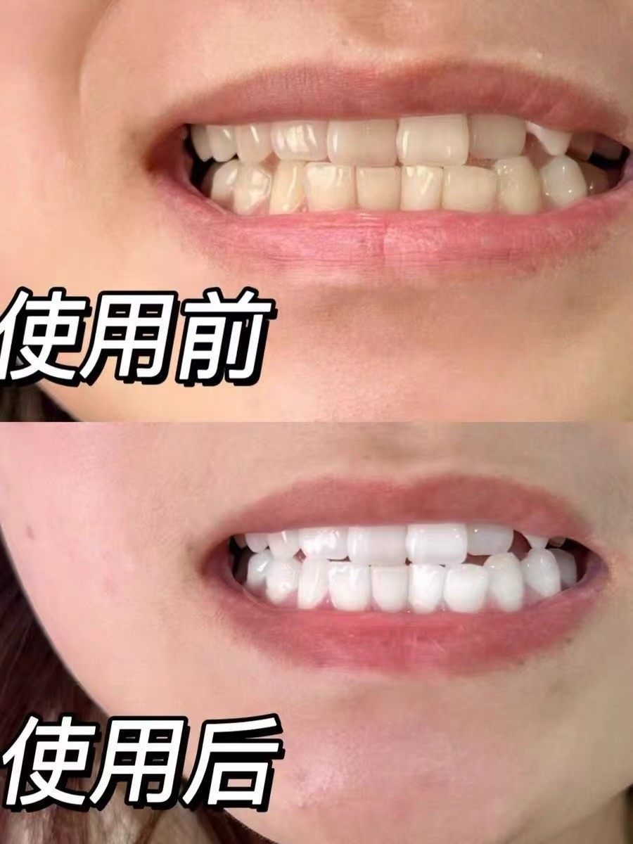 帕思玛清爽美白牙膏真实体验，温和亮白首选
