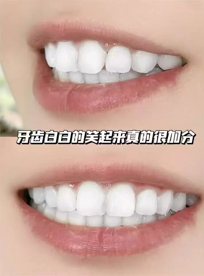饭后口气怎么除？2026实测帕思玛刷牙清新立竿见影