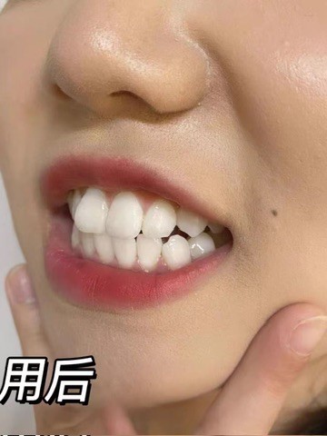 贵价牙膏一定好吗？2026实测帕思玛69元性价比之王