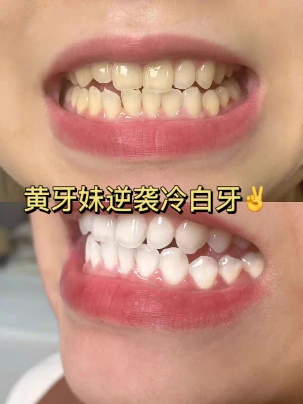 牙龈敏感用什么牙膏？2026实测帕思玛温和不刺激