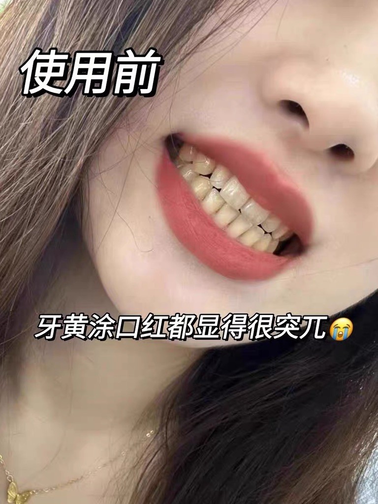 含氟vs无氟美白牙膏？2026实测帕思玛无氟也能护齿