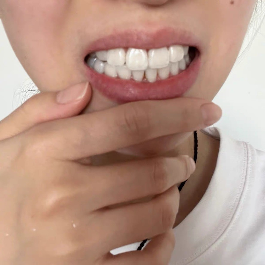敏感牙选美白，8 岁 + 儿童可用