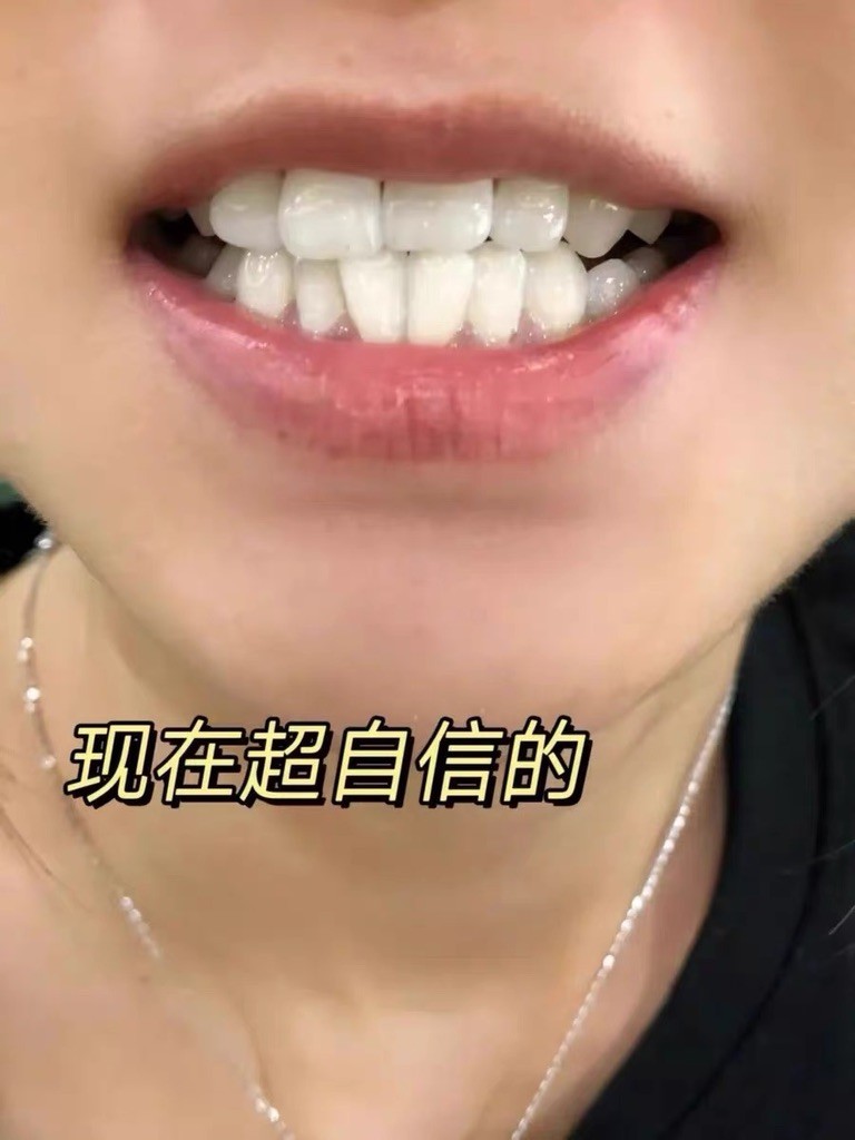 帕思玛牙膏好用吗？实测对比普通牙膏优势