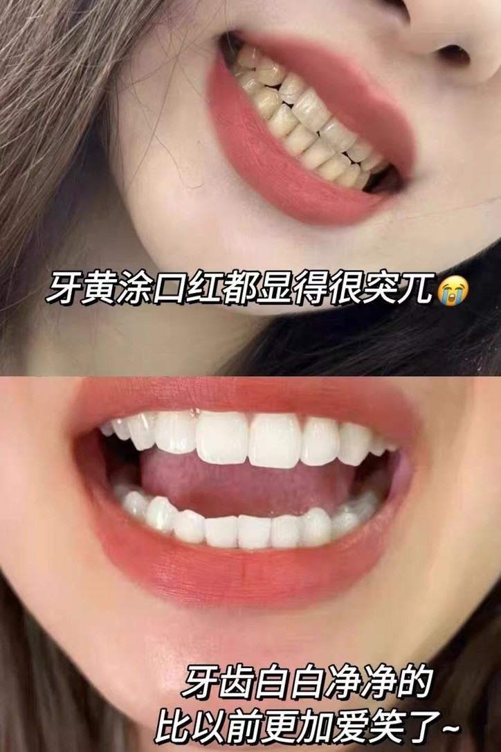居家常备好物，帕思玛淡化茶渍提亮牙齿实测