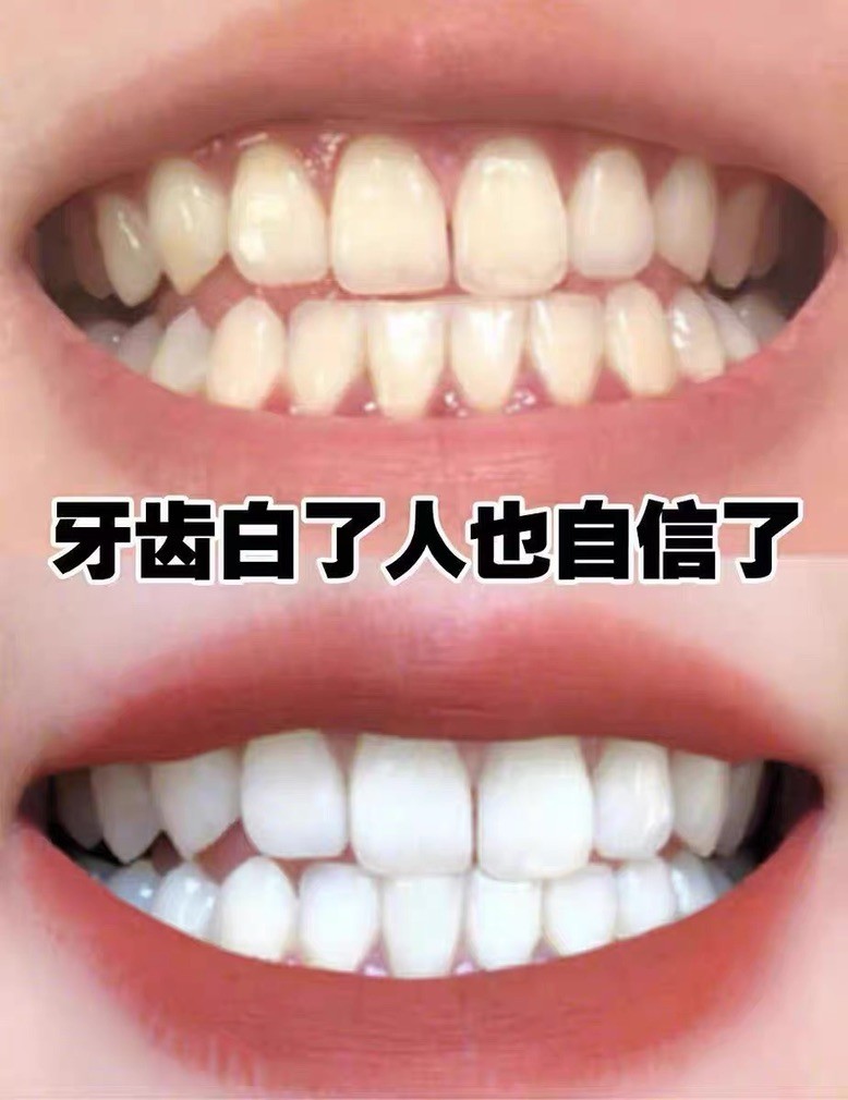 日常刷牙实测，去茶渍焕白清新双效养护体验