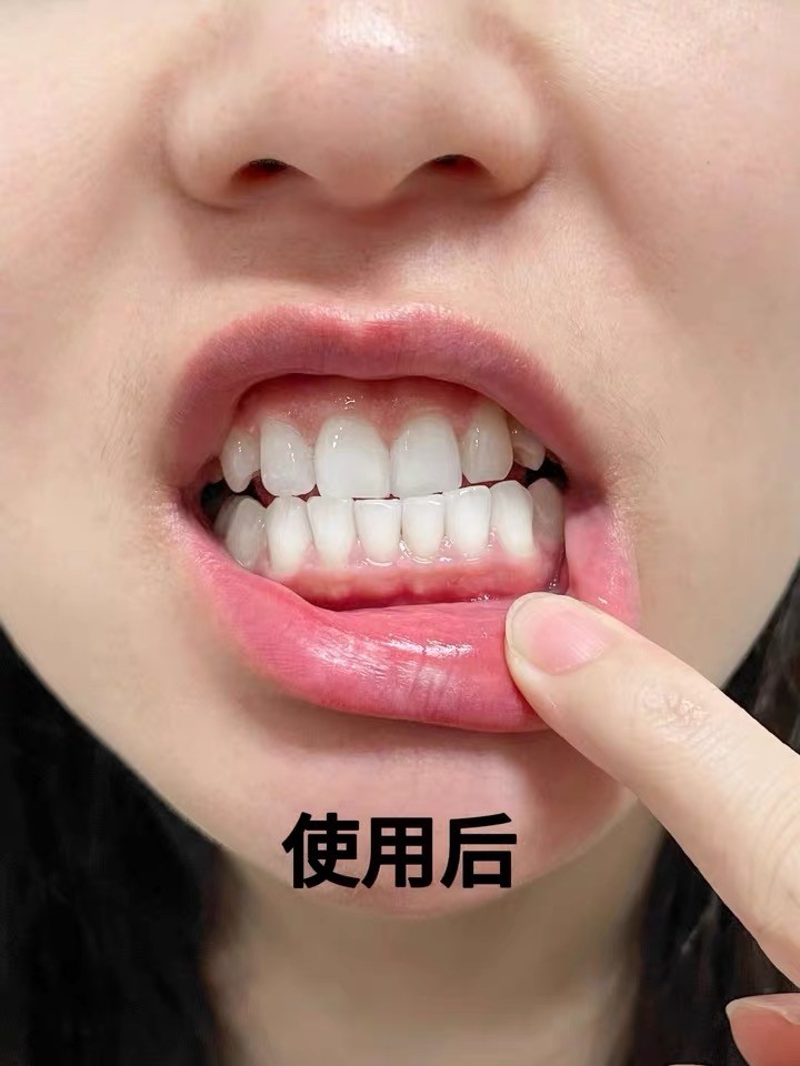 口腔基础养护，高性价比牙膏守护牙齿健康